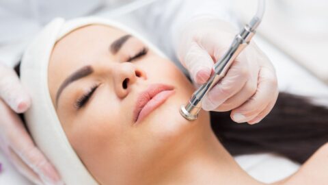 Microdermabrasion MPH